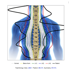 Detailed image of a human spine showing chiropractic adjustments and nerve pathways.